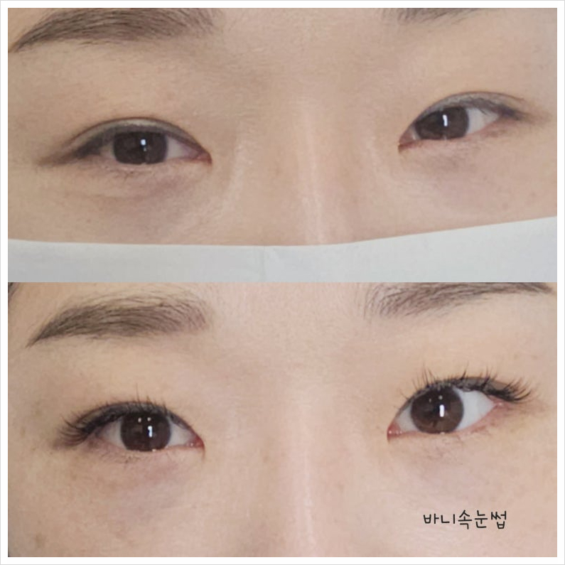 바니속눈썹 이미지