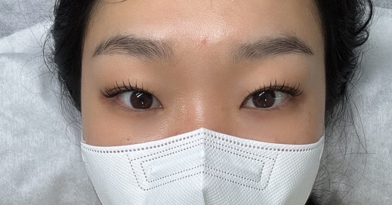 비니래쉬앤뷰티 이미지