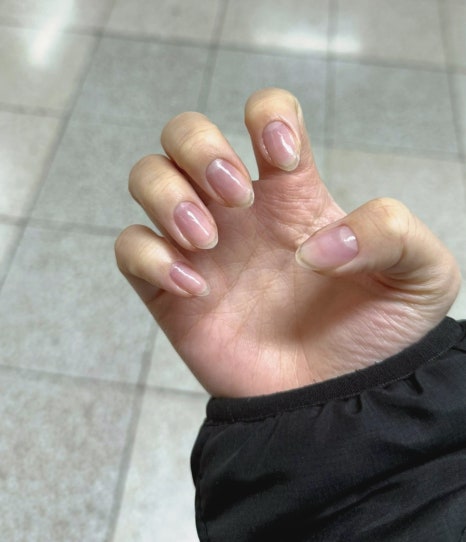 피어리스네일 이미지