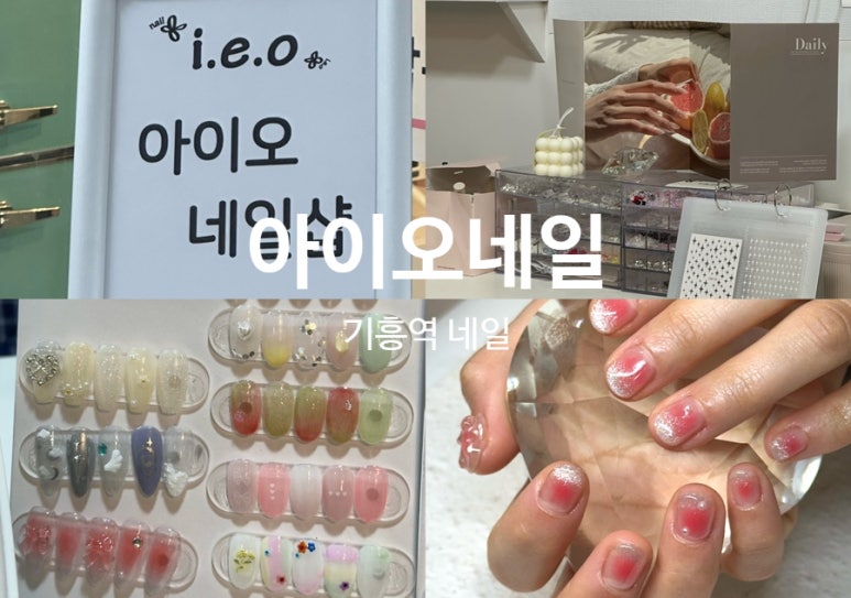 아이오네일 이미지