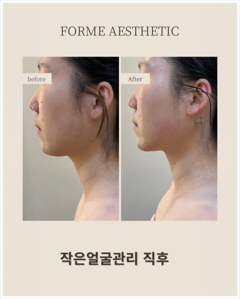 포미 이미지
