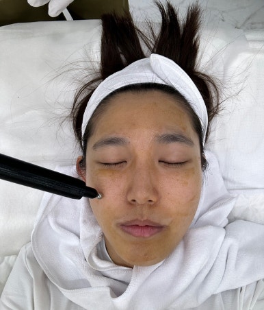 제이비비 이미지