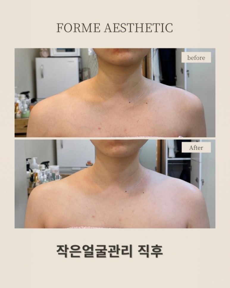 포미 이미지