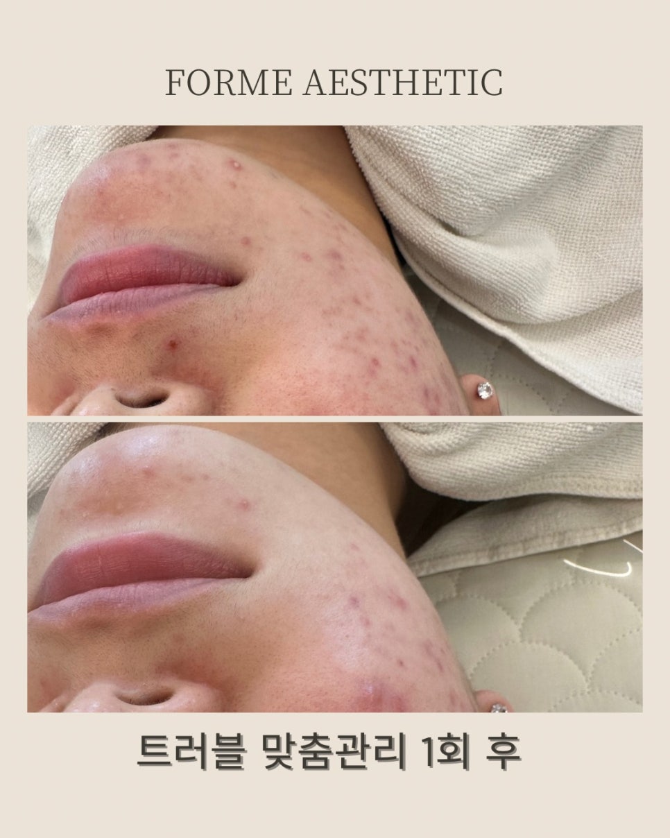 포미샵 이미지
