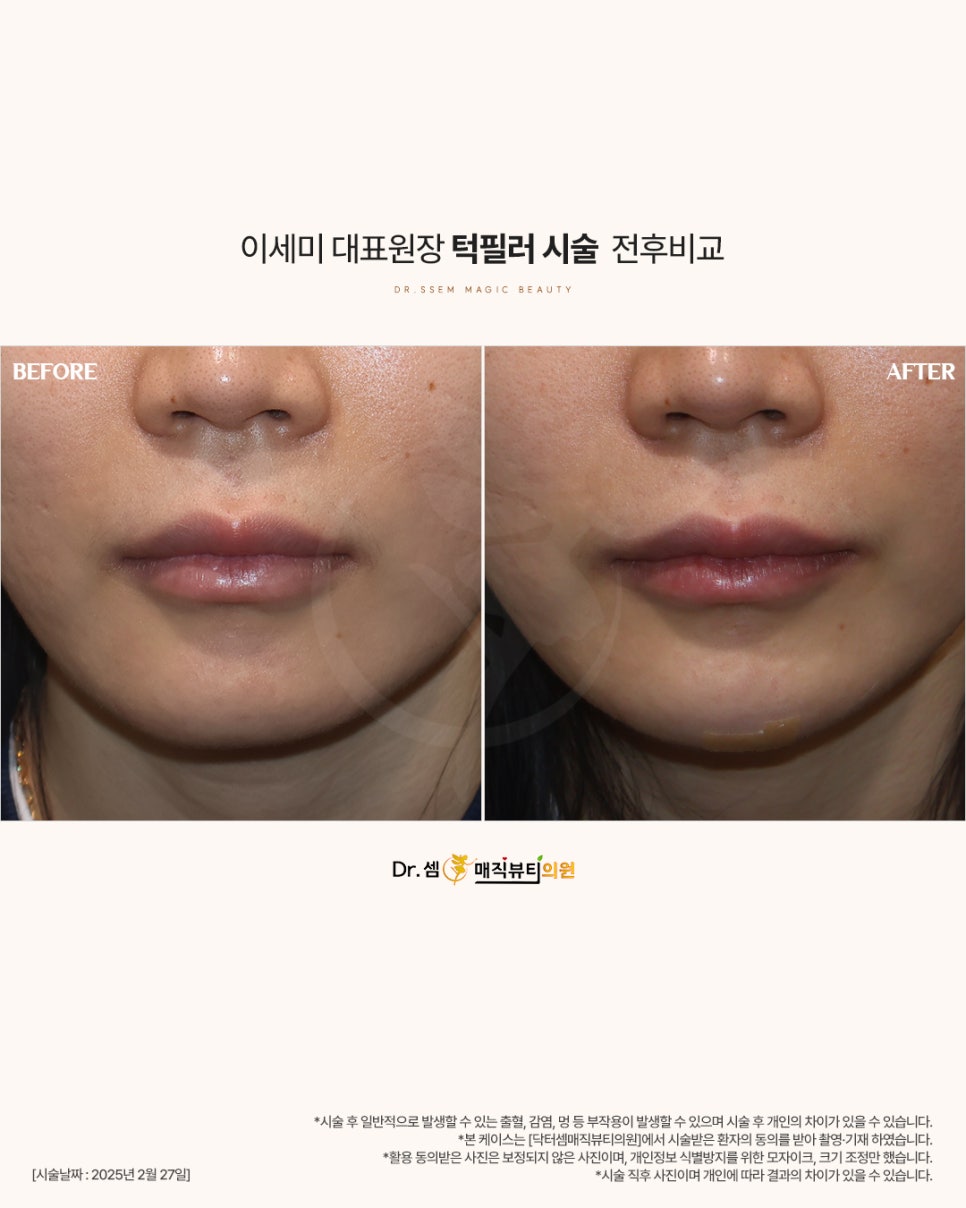 닥터셈매직뷰티 이미지