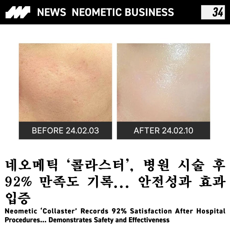 (주)네오스킨 이미지