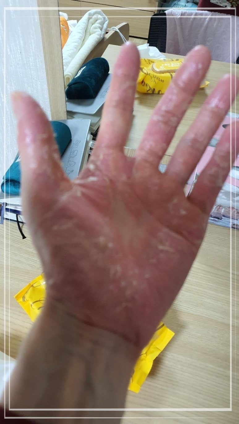 비고르바른건강 이미지