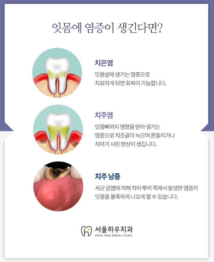 서울하우치과 이미지
