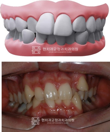 현치과교정과치과의원 이미지