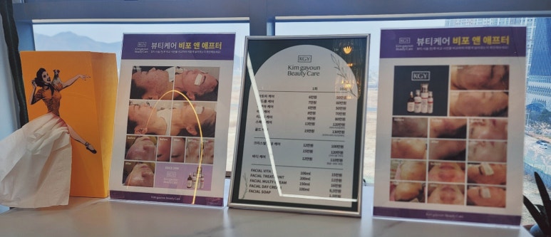 아우라 플라즈마 이미지