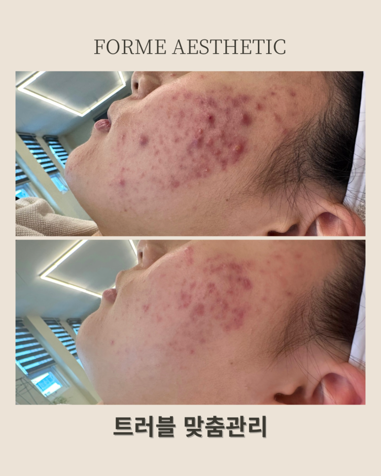 포미샵 이미지