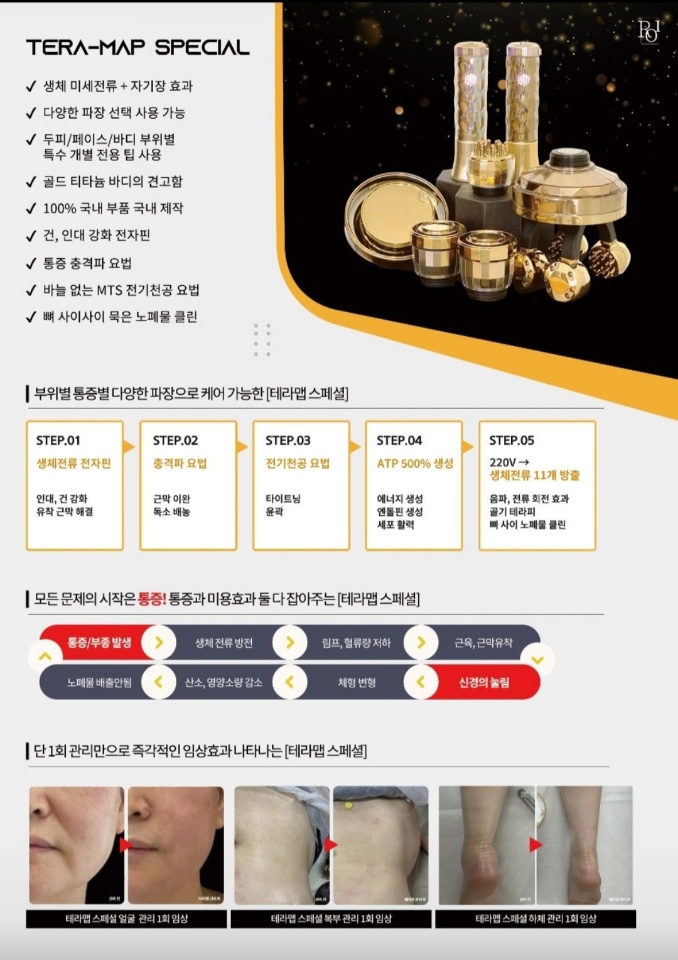엔쏘에스테틱 이미지