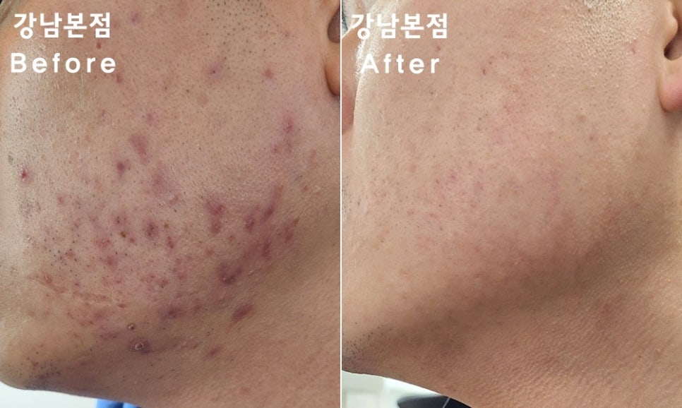 리유 이미지