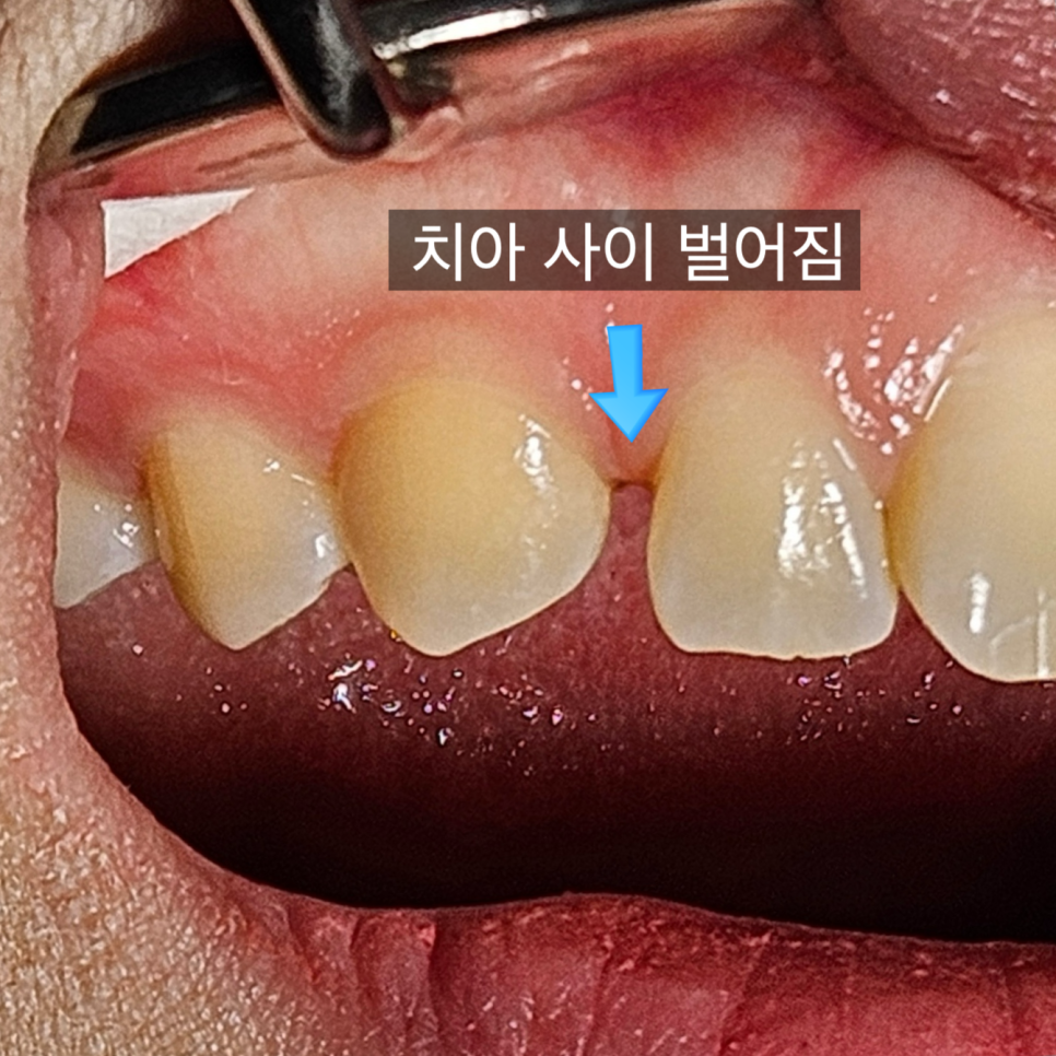 연세엘치과 이미지