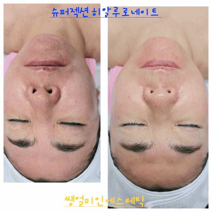 쌩얼라인 이미지