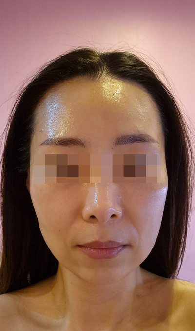 봄날에스테틱 이미지