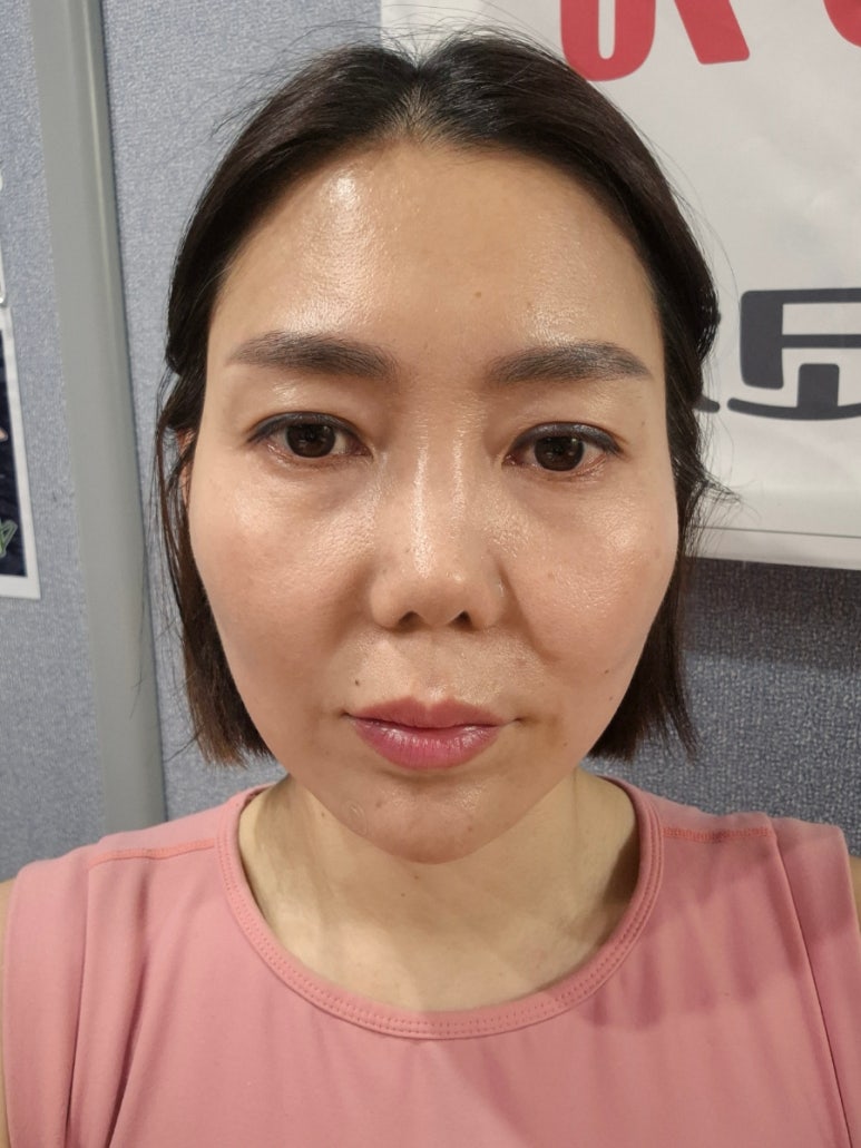 미미썸의원 이미지