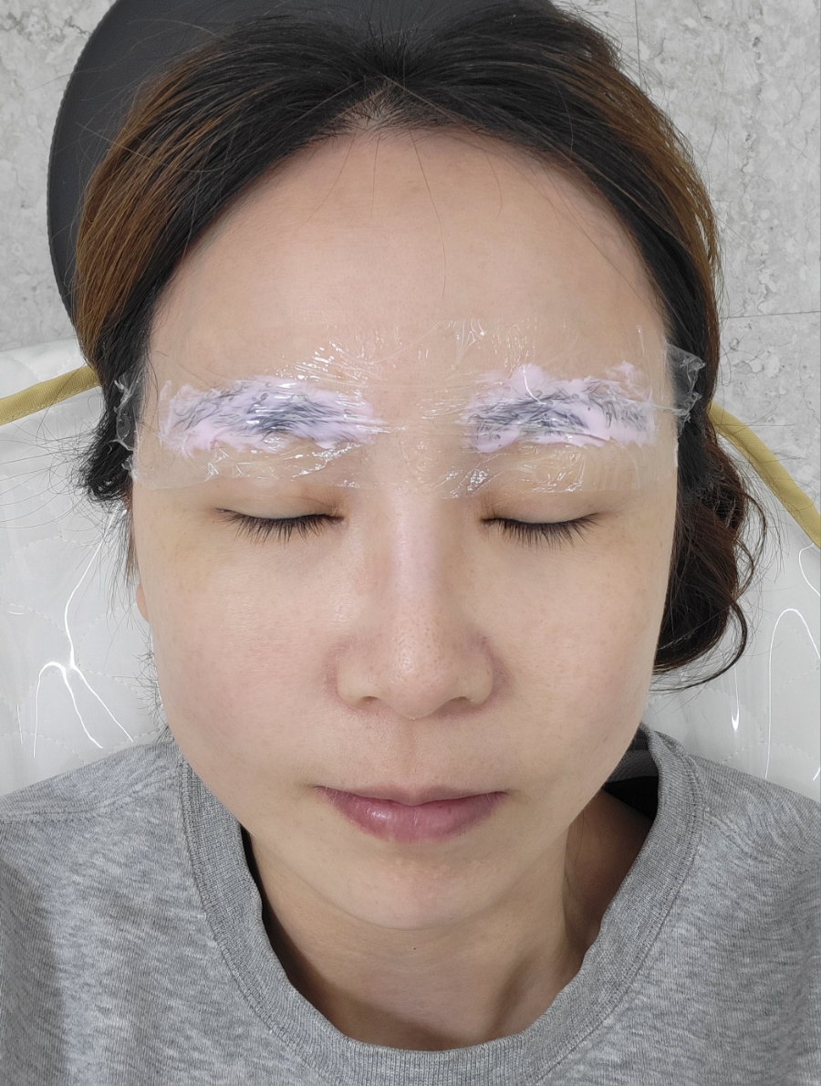 블레스옴 이미지