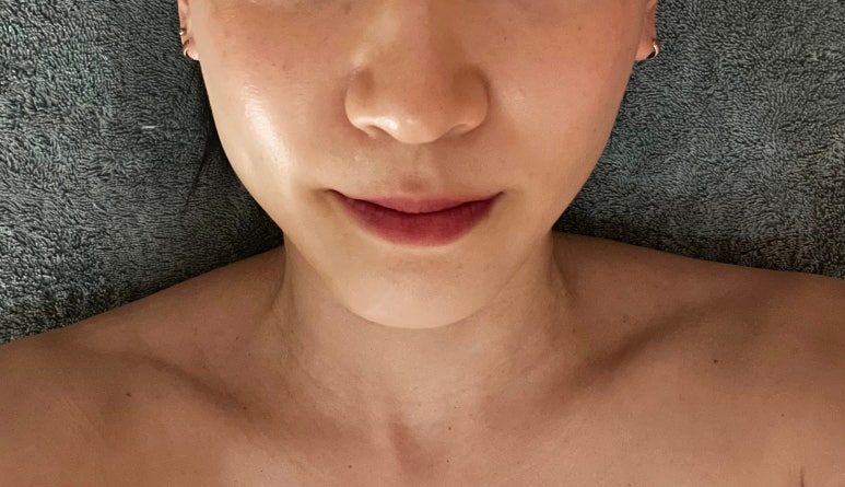 바른선 테라피 이미지