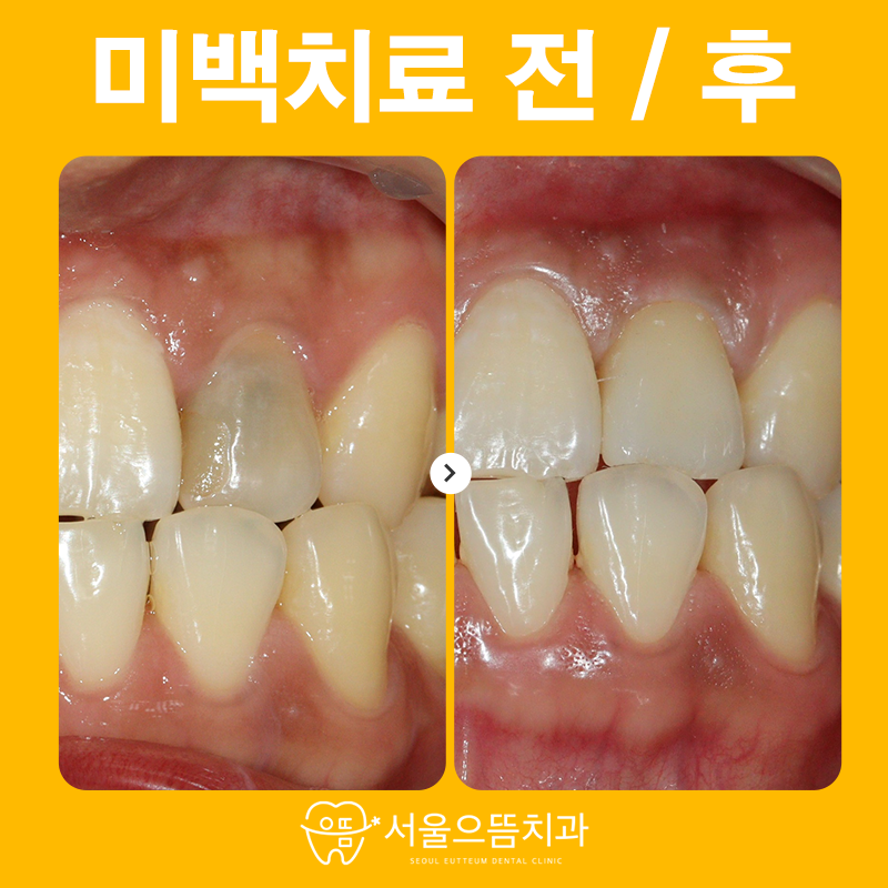 서울으뜸치과의원 이미지