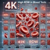 Apk Rdw RDW 수치란? RDW 수치 높으면, rdw 수치 증가 낮음의 의미 : 네이버 블로그