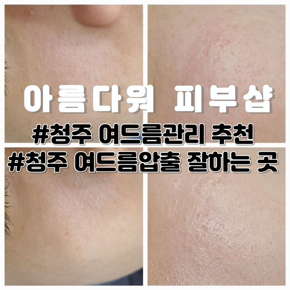 아름다워 피부샵 이미지