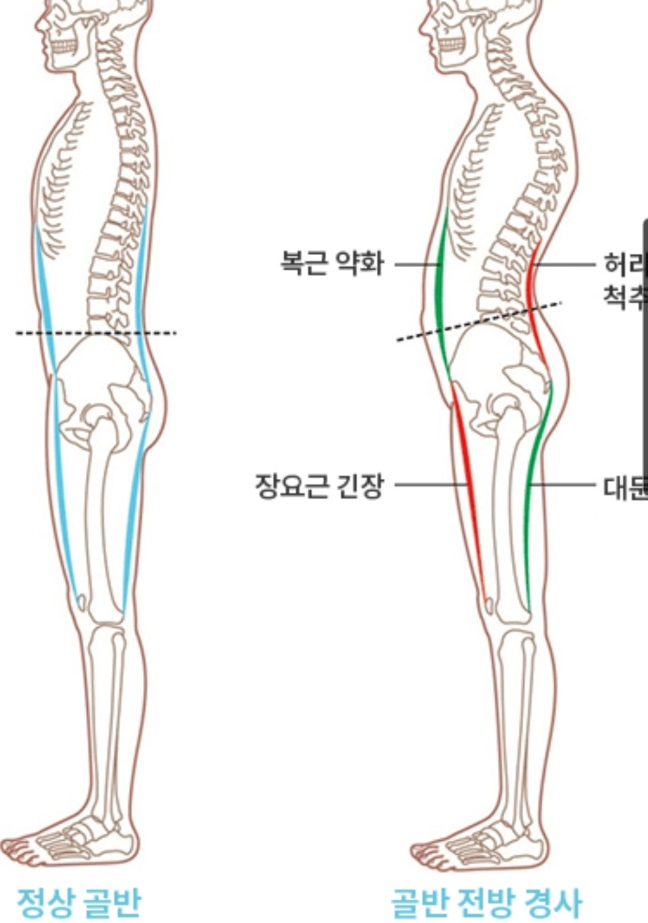 아이앤지짐 이미지