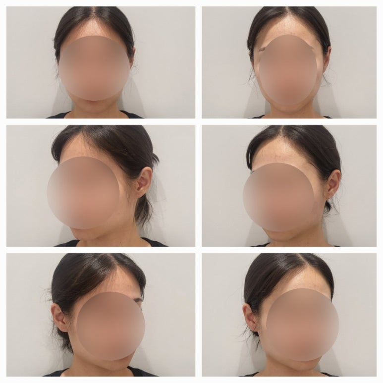 결이다른 이미지