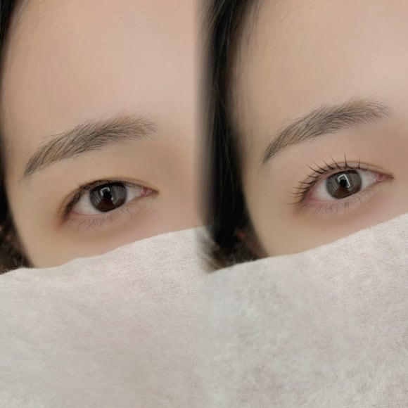 와이오엔 이미지