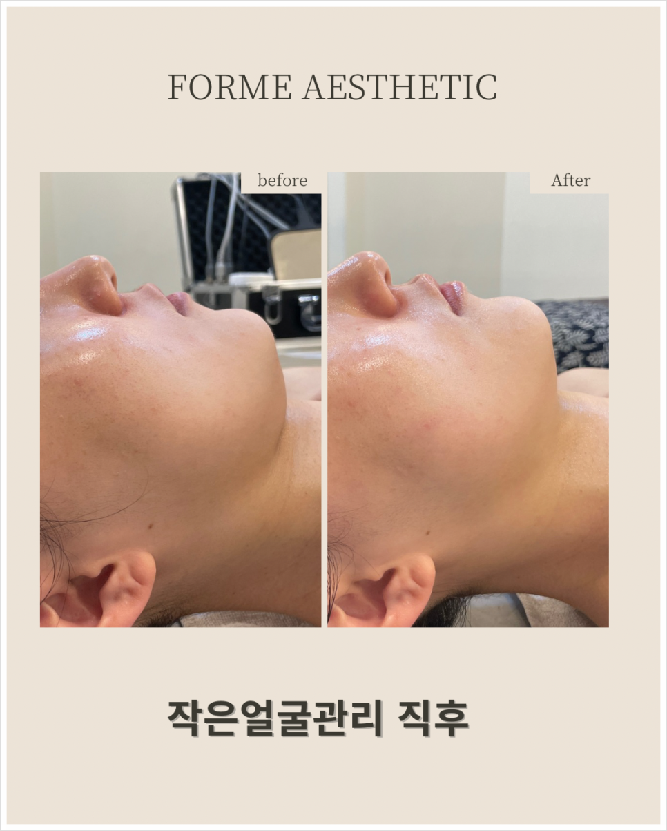 포미샵 이미지