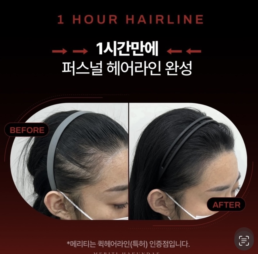 바다헤어라인 이미지