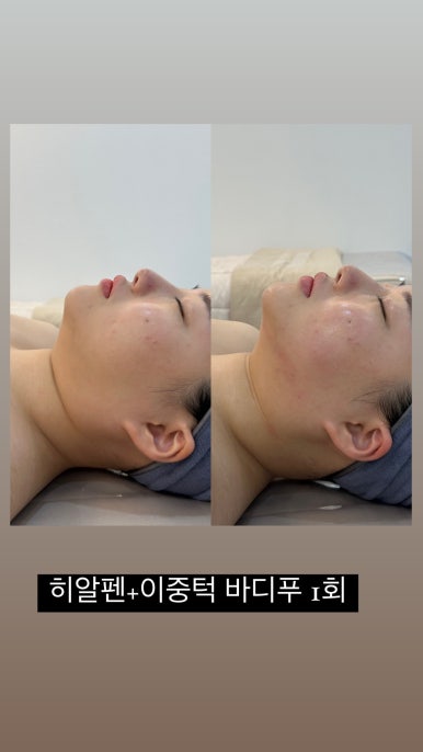 누보드스킨 이미지