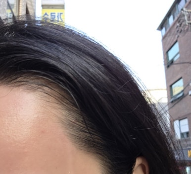 미가헤어라인 이미지