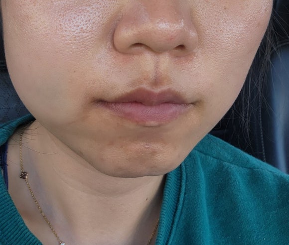 수성사랑니치과의원 이미지