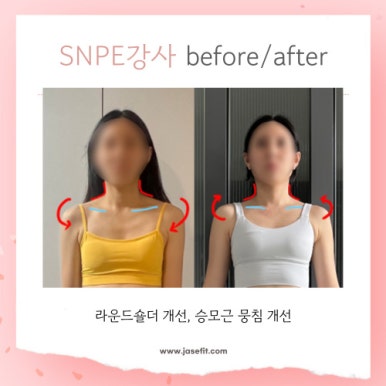 미노원 이미지