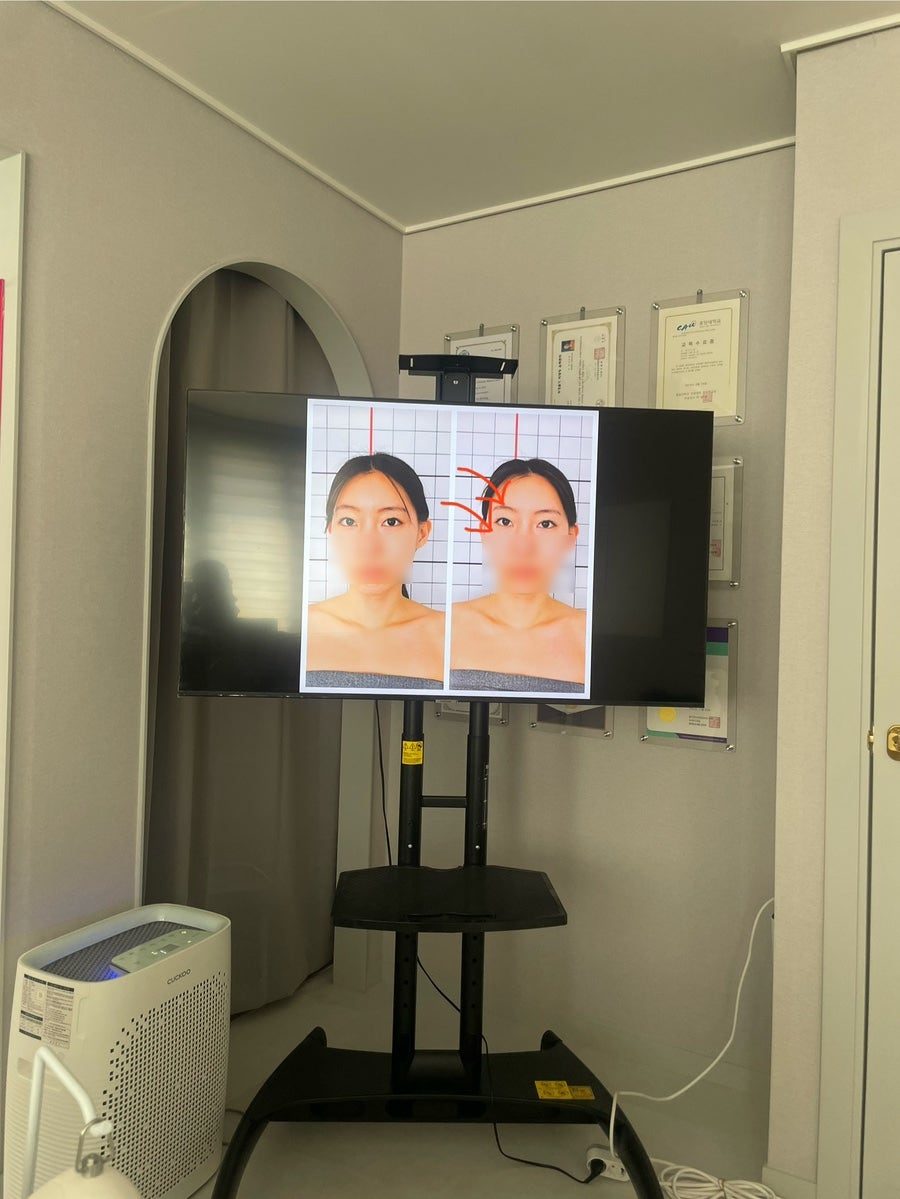 금손체형관리 이미지