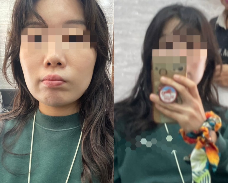 머리 못하는 집 이미지