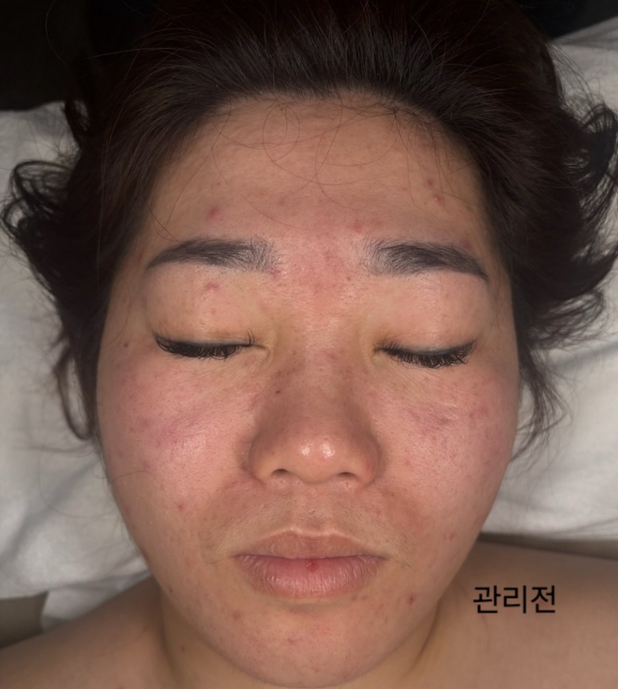 광주상무점 디바스킨 이미지