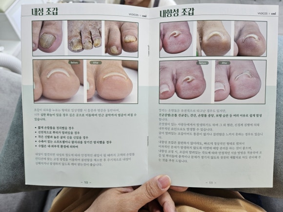 비앤브이 이미지