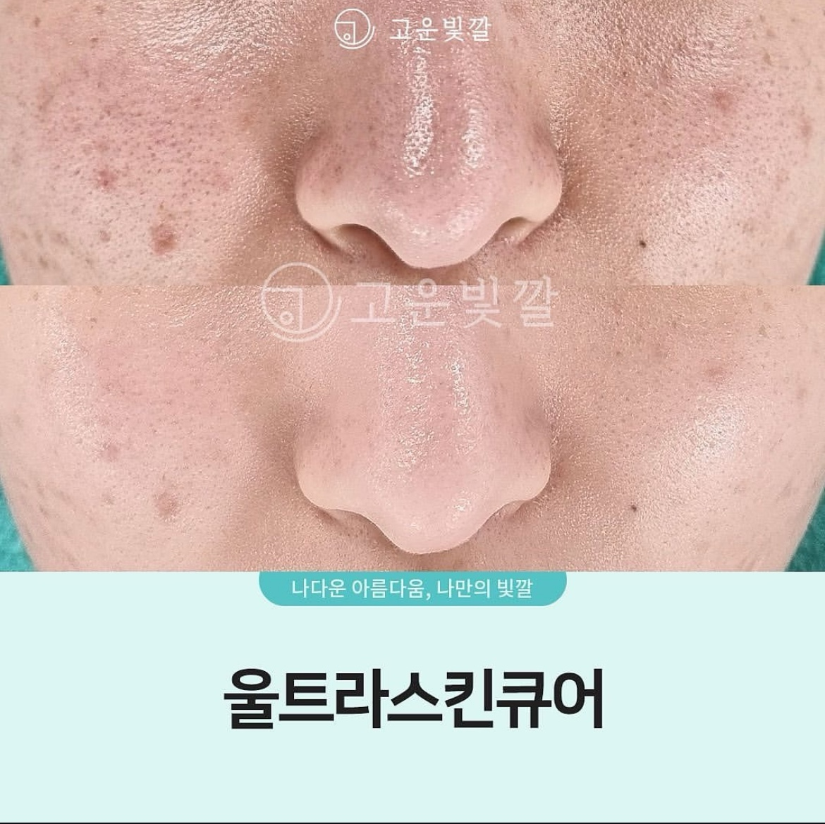 고운스킨케어 이미지
