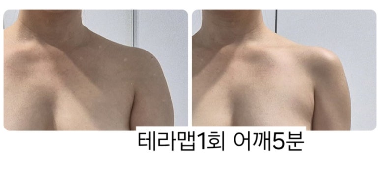 조이디바이스 이미지