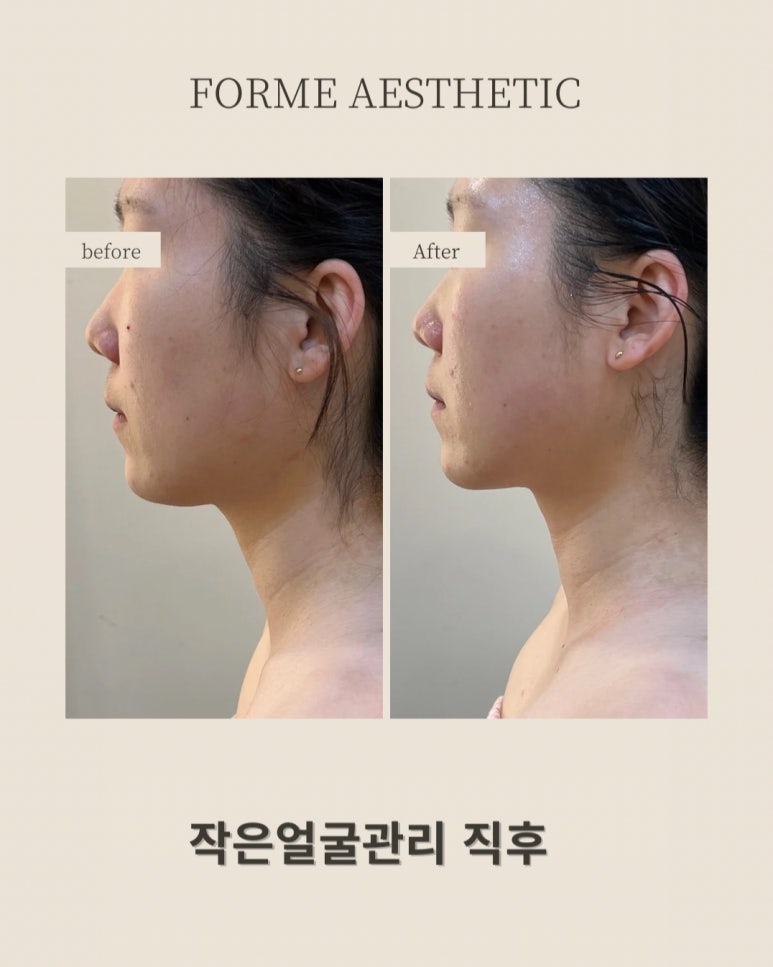 포미샵 이미지