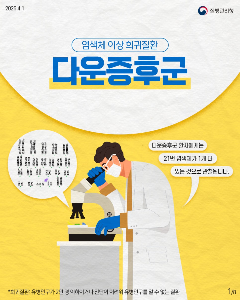 다운성 이미지