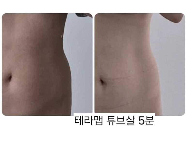 조이디바이스 이미지