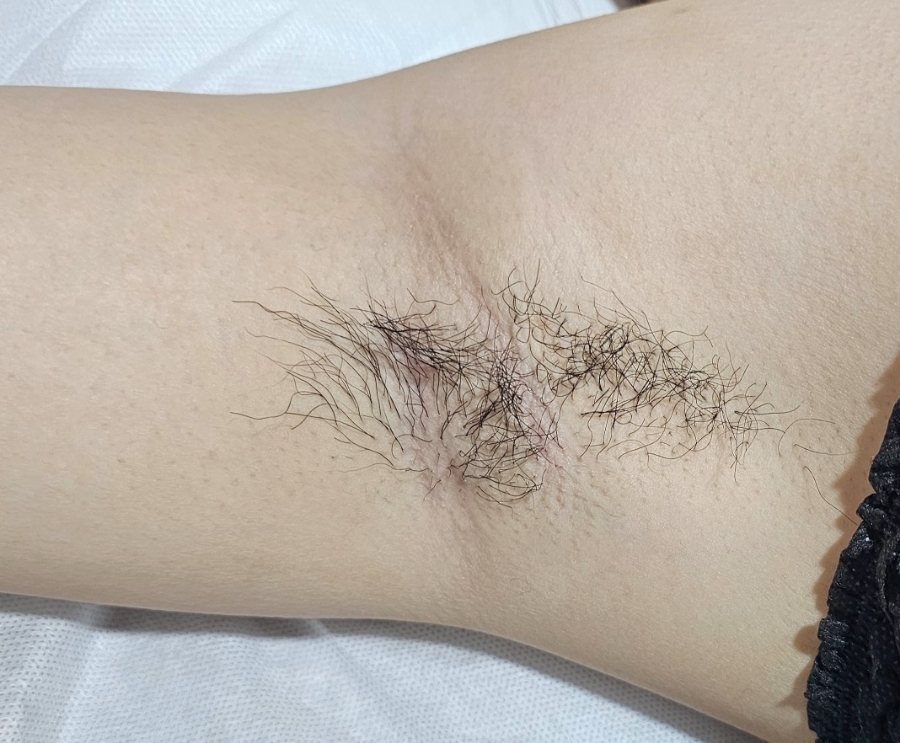 판디스 이미지