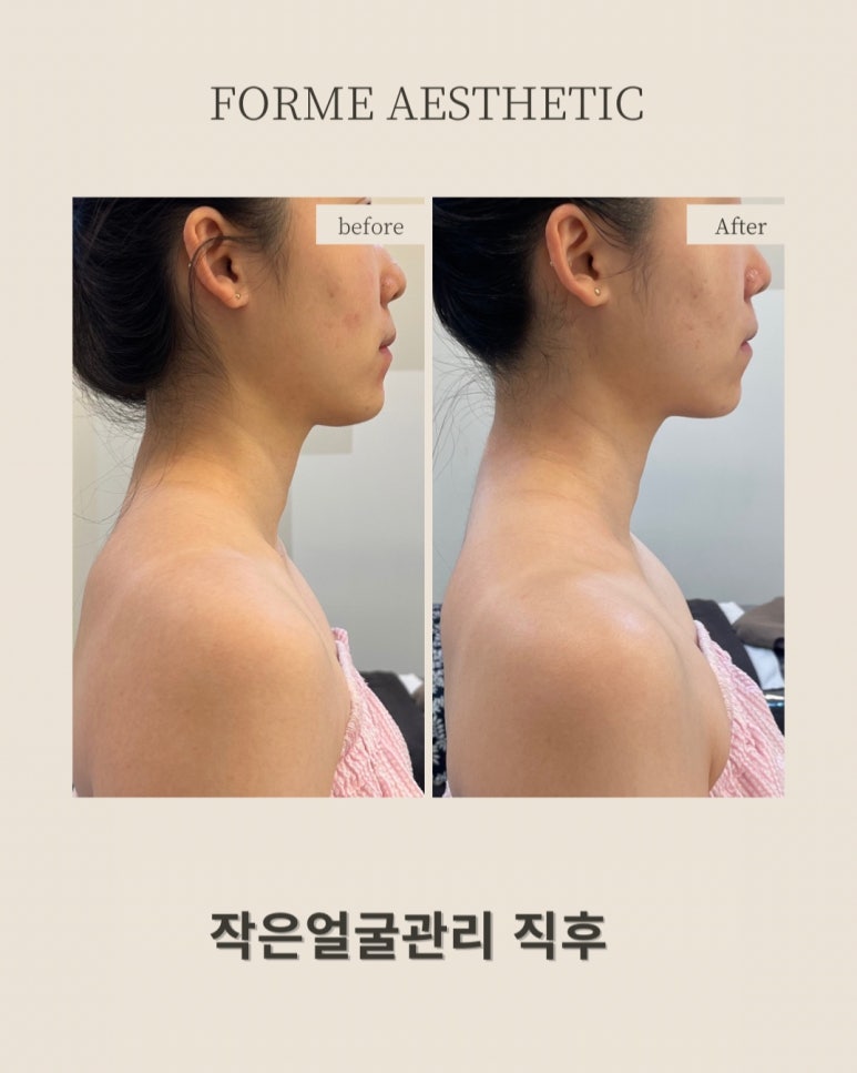 포미샵 이미지