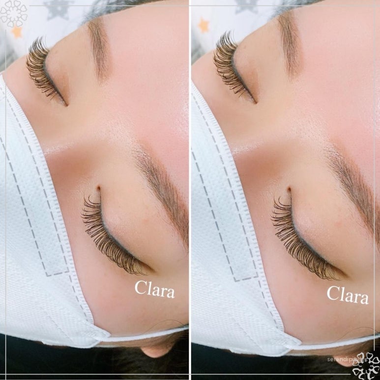 클라라뷰티라인 이미지