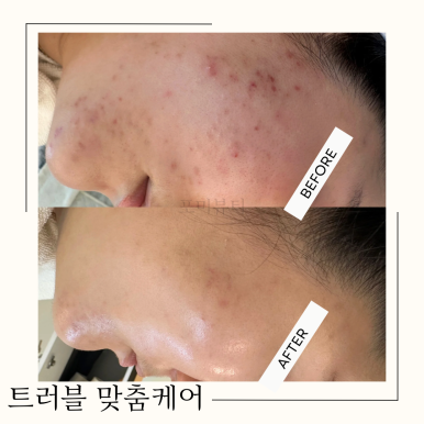 포미샵 이미지