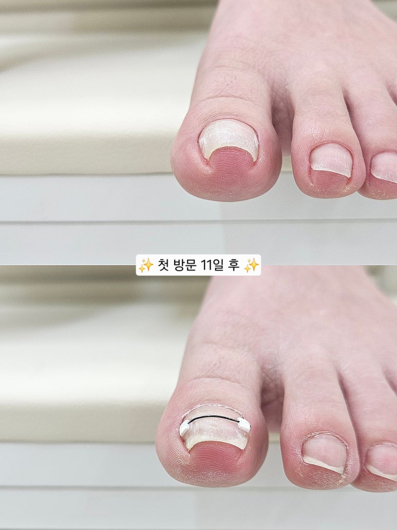 장꾸네일 이미지