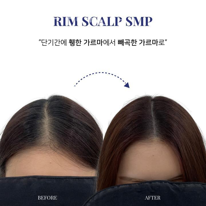 림스칼프 이미지